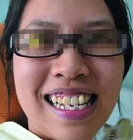 成人牙齿难看的视频,揭秘成人牙齿难看背后的秘密与改善之道